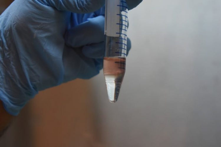 Penn Med study finds economic distress contributes to death from cardiovascular disease