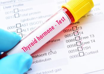 High TSH, Low FT4 Within Reference Ranges Linked to Cardiometabolic Risk in Youth
