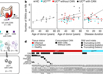 Somatic inflammatory gene mutations in human ulcerative colitis epithelium