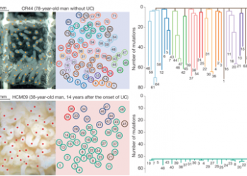 Frequent mutations that converge on the NFKBIZ pathway in ulcerative colitis