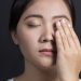 Dry Eye Symptoms Associated With Reduced Visual Quality of Life in Migraine