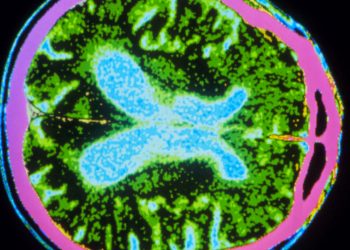 Is Tasigna (Or Nilotinib) Worth Testing For Parkinson’s? : Shots