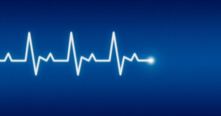 Simple ECG score helps estimate MI infarct size