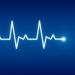 Simple ECG score helps estimate MI infarct size