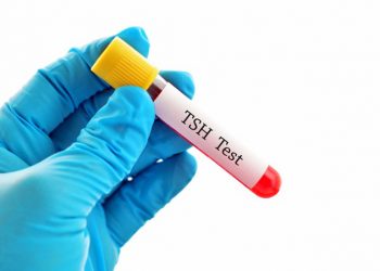 Positive associations observed between maternal, umbilical cord and 3-year-old TSH concentrations