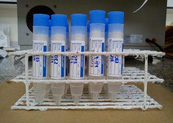 Saliva can be used to predict excess body fat in teenagers