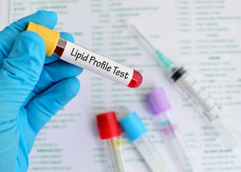Hyperlipidemia Onset May Occur Earlier in Patients With Multiple Sclerosis