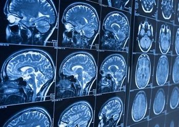 The Evolution Of Medical Imaging In Clinical Research