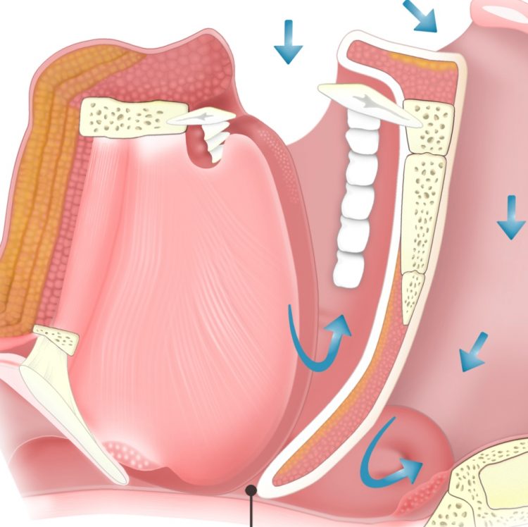 Atomoxetine Plus Oxybutynin Improves Multiple Variables in Obstructive Sleep Apnea