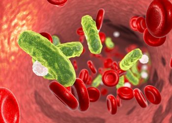 Sepsis Incidence Underestimated, Remains Major Health Burden Worldwide