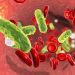 Sepsis Incidence Underestimated, Remains Major Health Burden Worldwide