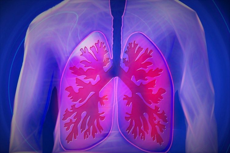 COPD Rates in Women with HIV 54% Higher Than HIV-Negative Women: Study