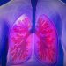 COPD Rates in Women with HIV 54% Higher Than HIV-Negative Women: Study