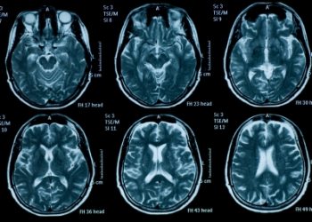 Esomar publishes guide to commissioning neuroscience | News