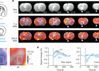 Local and global consequences of reward-evoked striatal dopamine release