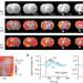 Local and global consequences of reward-evoked striatal dopamine release