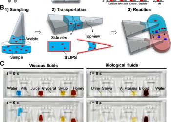 SLIPS-LAB—A bioinspired bioanalysis system for metabolic evaluation of urinary stone disease