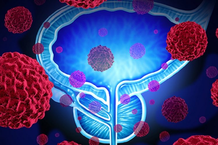 AMERICAN UROLOGICAL ASSOCIATION: Studies Highlight Barriers to and Disparities in Access to Care for Patients with Prostate Disease