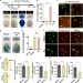 Mfsd2a and Spns2 are essential for sphingosine-1-phosphate transport in the formation and maintenance of the blood-brain barrier