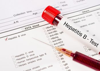 Duration of Hepatitis B Surface Antigen Exposure Contributes to Immune Response in Chronic HBV Infection