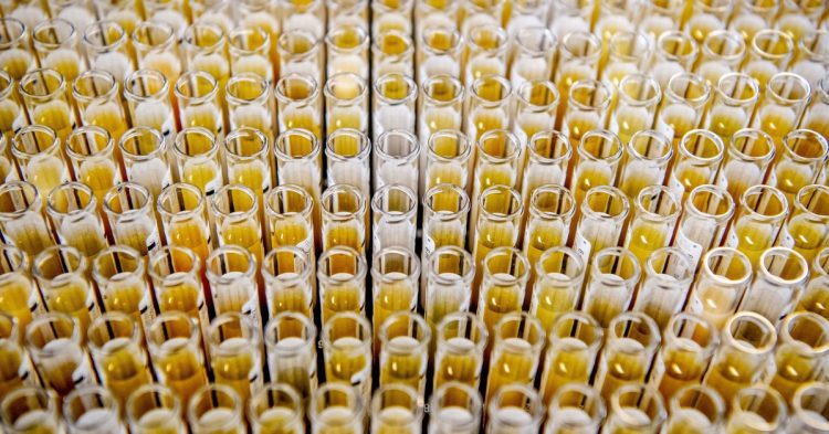 Antivirus: A weekly digest of the latest COVID-19 research