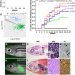 ARID1A loss in neuroblastoma promotes the adrenergic-to-mesenchymal transition by regulating enhancer-mediated gene expression