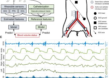 Enabling the assessment of trauma-induced hemorrhage via smart wearable systems
