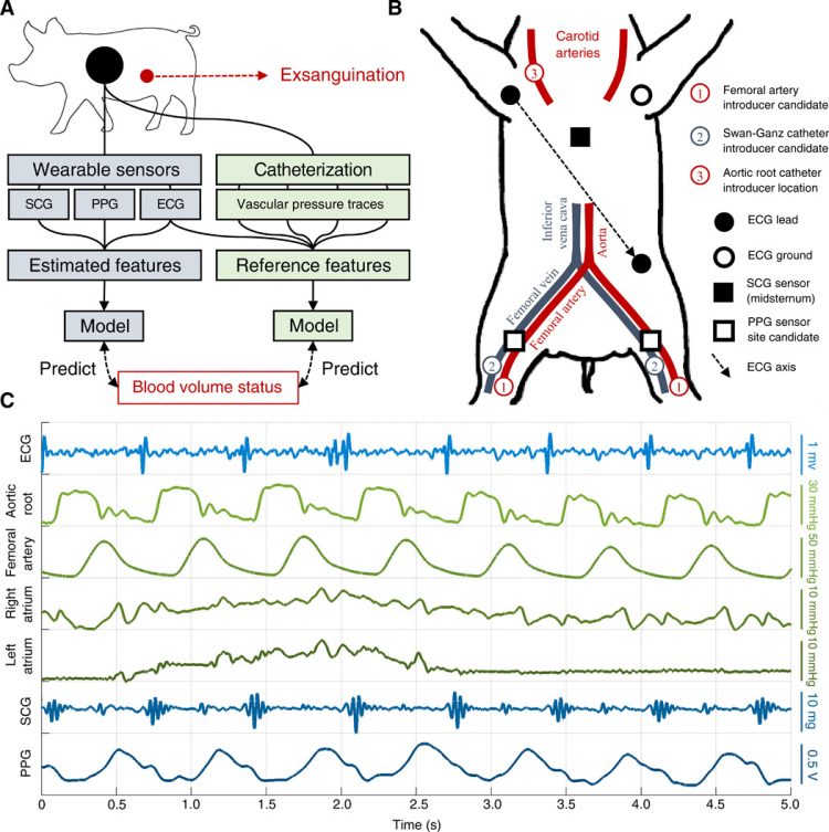 Enabling the assessment of trauma-induced hemorrhage via smart wearable systems