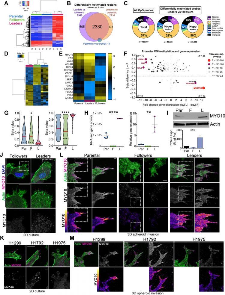 Epigenetically heterogeneous tumor cells direct collective invasion through filopodia-driven fibronectin micropatterning