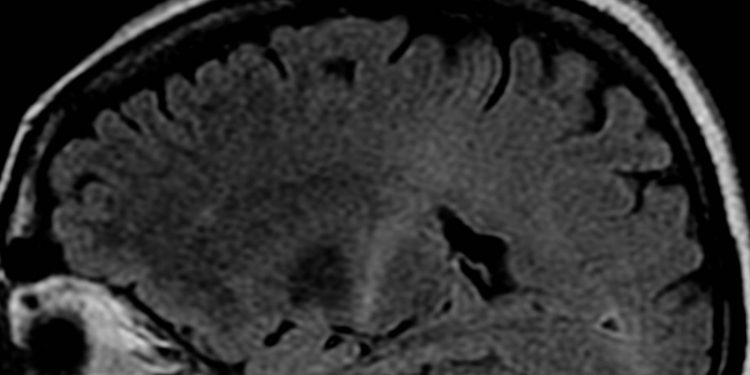 2 Minute Medicine Rewind July 13, 2020