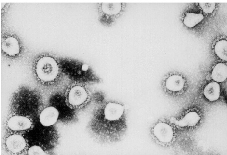 July 1 coronavirus roundup for San Benito County
