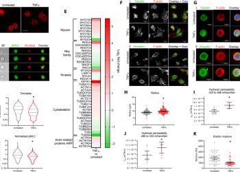 Actomyosin contractility confers mechanoprotection against TNFα-induced disruption of the intervertebral disc