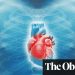 Severe lack of funding for heart disease research revealed | Society