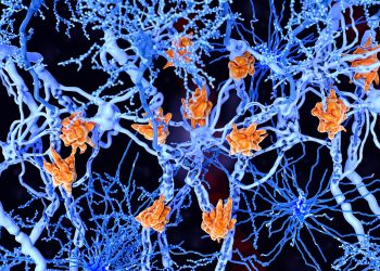 Ped-MSSS Provides Alternative to EDSS in Pediatric-Onset Multiple Sclerosis