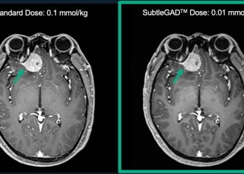 Subtle Medical Awarded Phase II Funding of $1.6 Million SBIR Grant for Safer MRI Exams and Named to CB Insights Digital Health 150