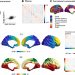 Shaping brain structure: Genetic and phylogenetic axes of macroscale organization of cortical thickness