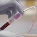 FDA approves liquid biopsy tests that can improve treatment
