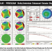 Working out the mystery of ectasia risk with artificial intelligence