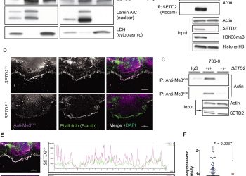 The Huntingtin-interacting protein SETD2/HYPB is an actin lysine methyltransferase