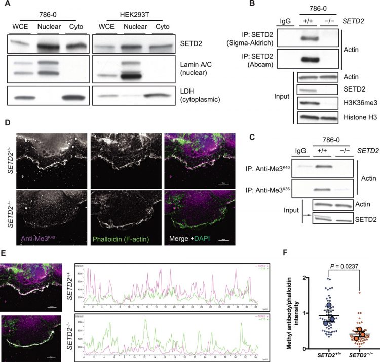The Huntingtin-interacting protein SETD2/HYPB is an actin lysine methyltransferase