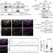 The Huntingtin-interacting protein SETD2/HYPB is an actin lysine methyltransferase