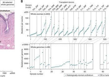 Extensive heterogeneity in somatic mutation and selection in the human bladder