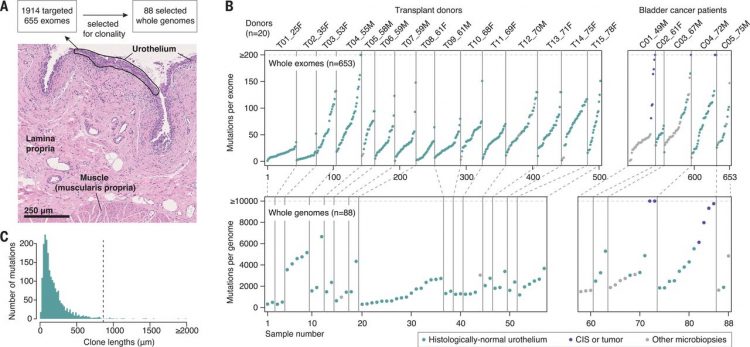 Extensive heterogeneity in somatic mutation and selection in the human bladder