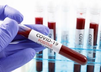 Coronavirus live updates: COVID-19 positivity rates rising in 37 US states, analysis shows