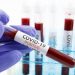 Coronavirus live updates: COVID-19 positivity rates rising in 37 US states, analysis shows