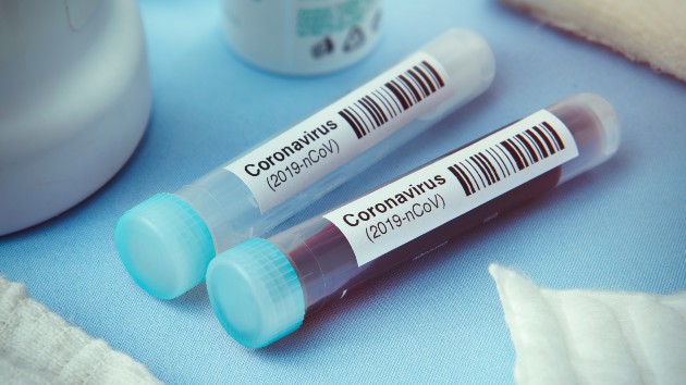 Coronavirus live updates: Birx warns of ‘troubling signs’ in Northeast amid ‘very different’ spread of COVID-19