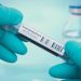 Coronavirus updates: Global airline body developing COVID-19 ‘Travel Pass’ | National
