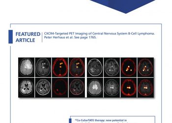 Reshaping the Amyloid Buildup Curve in Alzheimer Disease? Partial-Volume Effect Correction of Longitudinal Amyloid PET Data