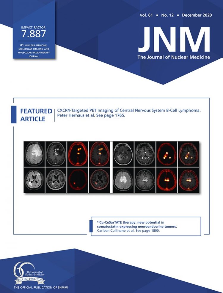 Reshaping the Amyloid Buildup Curve in Alzheimer Disease? Partial-Volume Effect Correction of Longitudinal Amyloid PET Data
