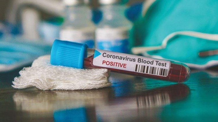 State and county case totals climb, Brown’s state of emergency lasts into March